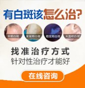 <b>白癜风应该怎么护理呢？</b>